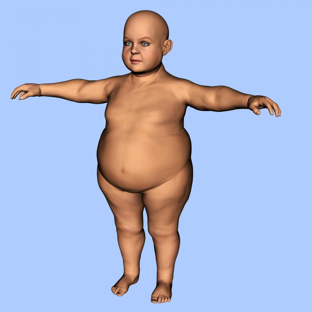 Child Overweight